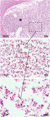 Strategies to Improve Vaccine Efficacy against Tuberculosis by Targeting Innate Immunity